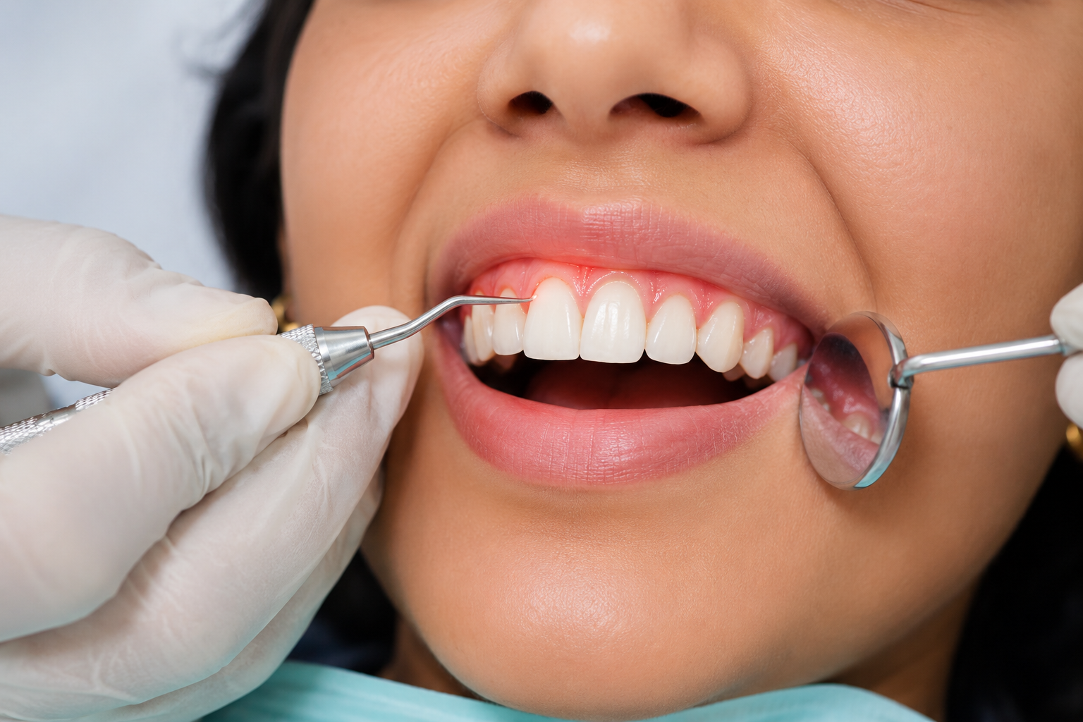 Gum Surgeries